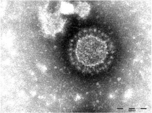 An image of porcine epidemic diarrhea virus under a microscope.